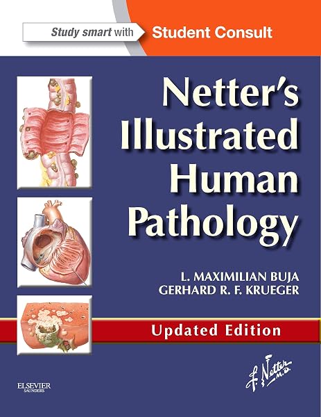 Cover of Netter's Illustrated Human Pathology Updated Edition: with Student Consult Access (Netter Basic Science)